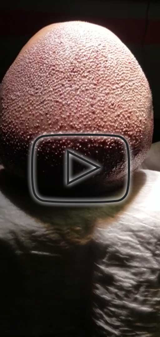 Gallery Thumb 1
